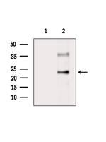 VTI1A Antibody in Western Blot (WB)