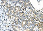 ZFYVE19 Antibody in Immunohistochemistry (Paraffin) (IHC (P))