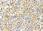 ZFYVE19 Antibody in Immunohistochemistry (Paraffin) (IHC (P))