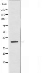 SLC39A9 Antibody in Western Blot (WB)