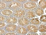 RAD51C Antibody in Immunohistochemistry (Paraffin) (IHC (P))