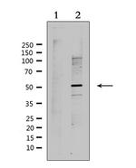 RAD51C Antibody in Western Blot (WB)