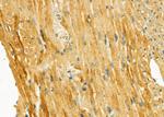 GNE Antibody in Immunohistochemistry (Paraffin) (IHC (P))