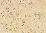 GNE Antibody in Immunohistochemistry (Paraffin) (IHC (P))