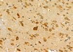 IL11RA Antibody in Immunohistochemistry (Paraffin) (IHC (P))