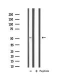 IL11RA Antibody in Western Blot (WB)