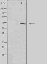 IL17RC Isoform 1 Precursor Antibody in Western Blot (WB)