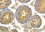 PLCB2 Antibody in Immunohistochemistry (Paraffin) (IHC (P))