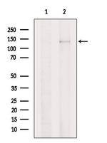 PLCB2 Antibody in Western Blot (WB)