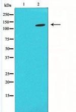 PLCB2 Antibody in Western Blot (WB)