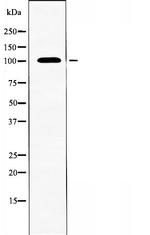 CNNM2 Antibody in Western Blot (WB)