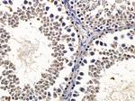 BCL7A Antibody in Immunohistochemistry (Paraffin) (IHC (P))