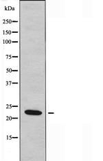 BCL7A Antibody in Western Blot (WB)