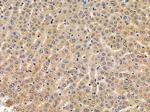 CYP4F11 Antibody in Immunohistochemistry (Paraffin) (IHC (P))