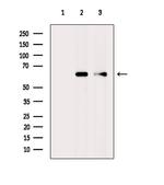 CYP4F11 Antibody in Western Blot (WB)