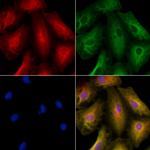 Kir2.3 (KCNJ4) Antibody in Immunocytochemistry (ICC/IF)