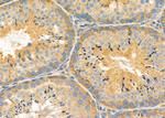 Kir2.3 (KCNJ4) Antibody in Immunohistochemistry (Paraffin) (IHC (P))