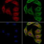 PHKG1 Antibody in Immunocytochemistry (ICC/IF)