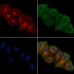 ERI1 Antibody in Immunocytochemistry (ICC/IF)