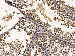 ERI1 Antibody in Immunohistochemistry (Paraffin) (IHC (P))