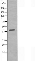 ERI1 Antibody in Western Blot (WB)