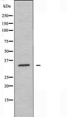 CD32 / FCGR2 Antibody in Western Blot (WB)