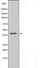 EDG6 Antibody in Western Blot (WB)