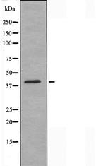 PTGER3 Antibody in Western Blot (WB)