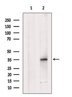 MC2R Antibody in Western Blot (WB)