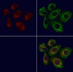 CYSLTR2 Antibody in Immunocytochemistry (ICC/IF)