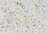 CYSLTR2 Antibody in Immunohistochemistry (Paraffin) (IHC (P))