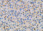 CYSLTR2 Antibody in Immunohistochemistry (Paraffin) (IHC (P))