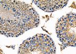 HRH1 Antibody in Immunohistochemistry (Paraffin) (IHC (P))