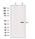 MTNR1B Antibody in Western Blot (WB)