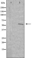 TMEM145 Antibody in Western Blot (WB)