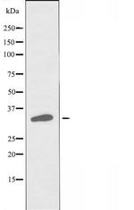 VN1R4 Antibody in Western Blot (WB)