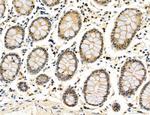 CHOP Antibody in Immunohistochemistry (Paraffin) (IHC (P))