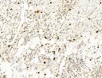 CHOP Antibody in Immunohistochemistry (Paraffin) (IHC (P))