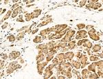 CHOP Antibody in Immunohistochemistry (Paraffin) (IHC (P))