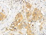 CHOP Antibody in Immunohistochemistry (Paraffin) (IHC (P))