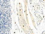 CHOP Antibody in Immunohistochemistry (Paraffin) (IHC (P))