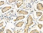 CHOP Antibody in Immunohistochemistry (Paraffin) (IHC (P))