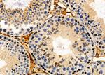 POLR1C Antibody in Immunohistochemistry (Paraffin) (IHC (P))