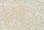 ACVR1C Antibody in Immunohistochemistry (Paraffin) (IHC (P))