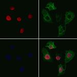 SMNDC1 Antibody in Immunocytochemistry (ICC/IF)