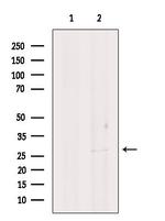 SMNDC1 Antibody in Western Blot (WB)