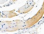 HK2 Antibody in Immunohistochemistry (Paraffin) (IHC (P))