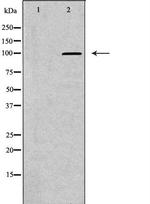 HK2 Antibody in Western Blot (WB)