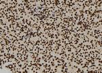 ENO1 Antibody in Immunohistochemistry (Paraffin) (IHC (P))