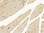 ENO1 Antibody in Immunohistochemistry (Paraffin) (IHC (P))